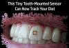 tiny-tooth-sensor-for-tracking-diet