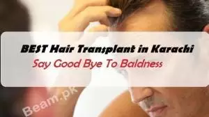 Best Hair Transplant in Karachi