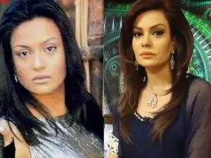 Sadia-Imam plastic surgery